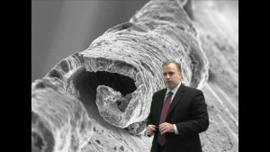 Episode 13: Eliminating burr