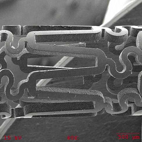 The cross sections of this laser-machined Nitinol stent measure 150µm (0.0059